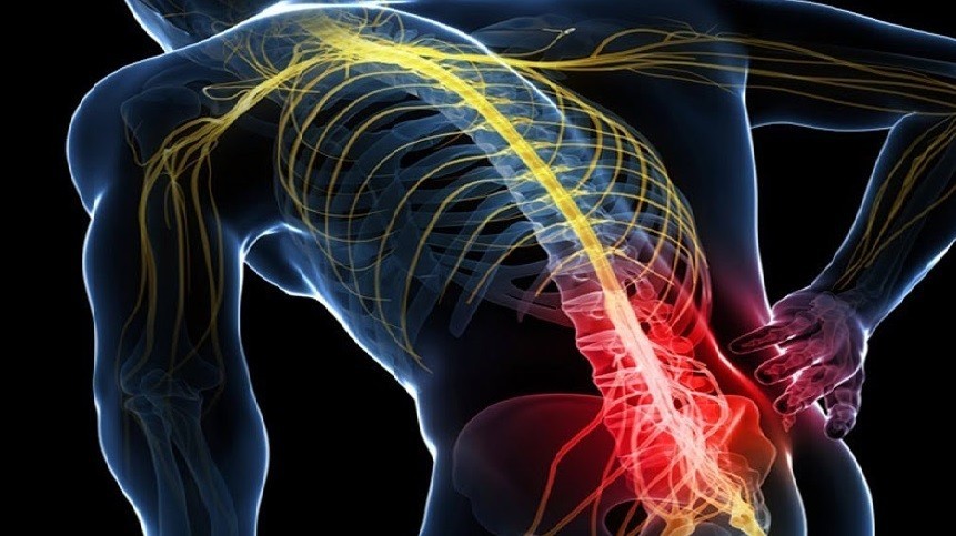 Sciatica lower back pain